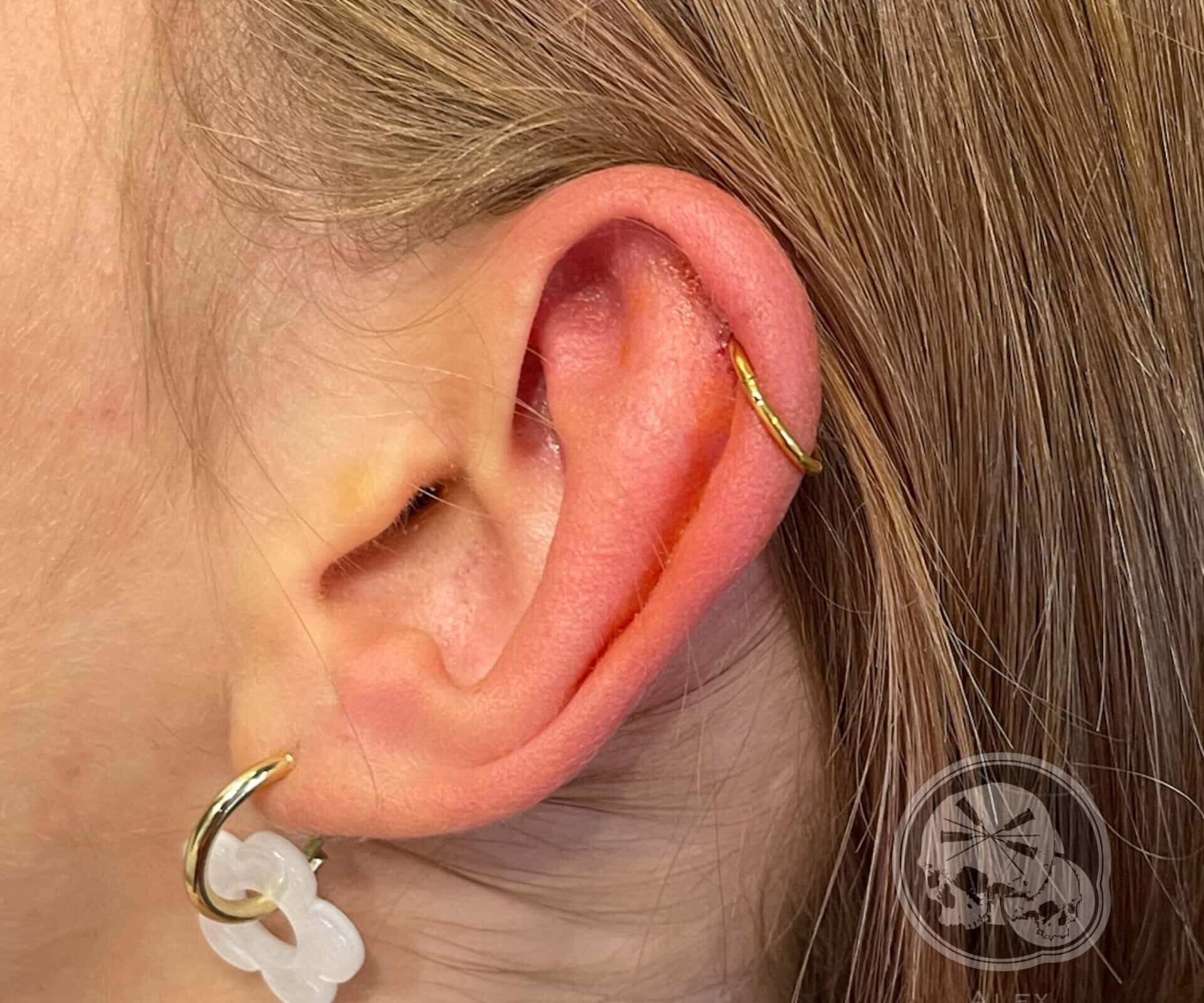 Piercing oreille helix avec anneau PVD gold – The Needles Factory Boulogne-sur-Mer Piercing oreille hélix avec anneau en or – The Needles Factory Boulogne-sur-Mer