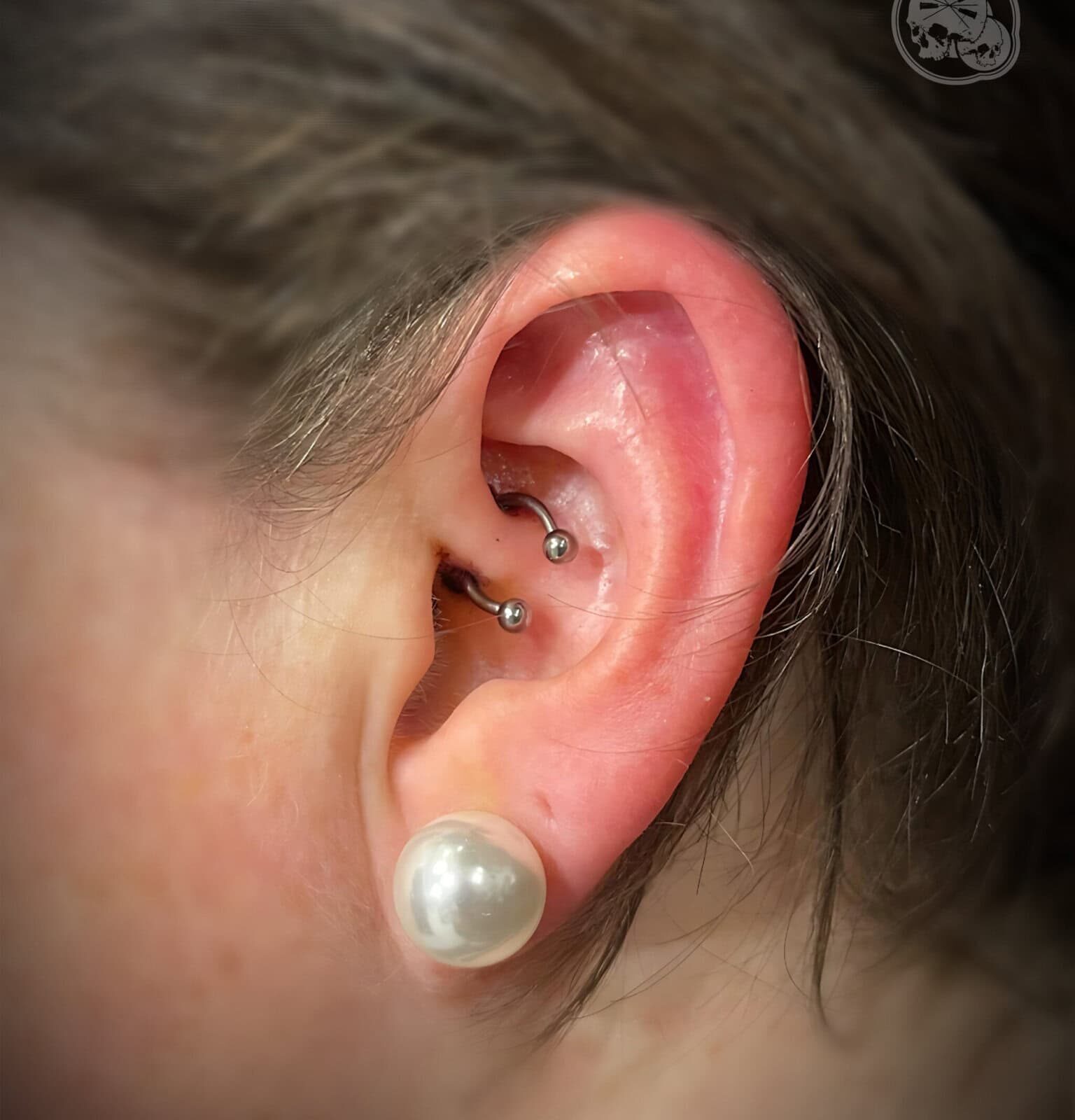 Piercing daith en titane – oreille – Boulogne-sur-Mer (62) | The Needles Factory Piercing daith en titane à Boulogne-sur-Mer (62)